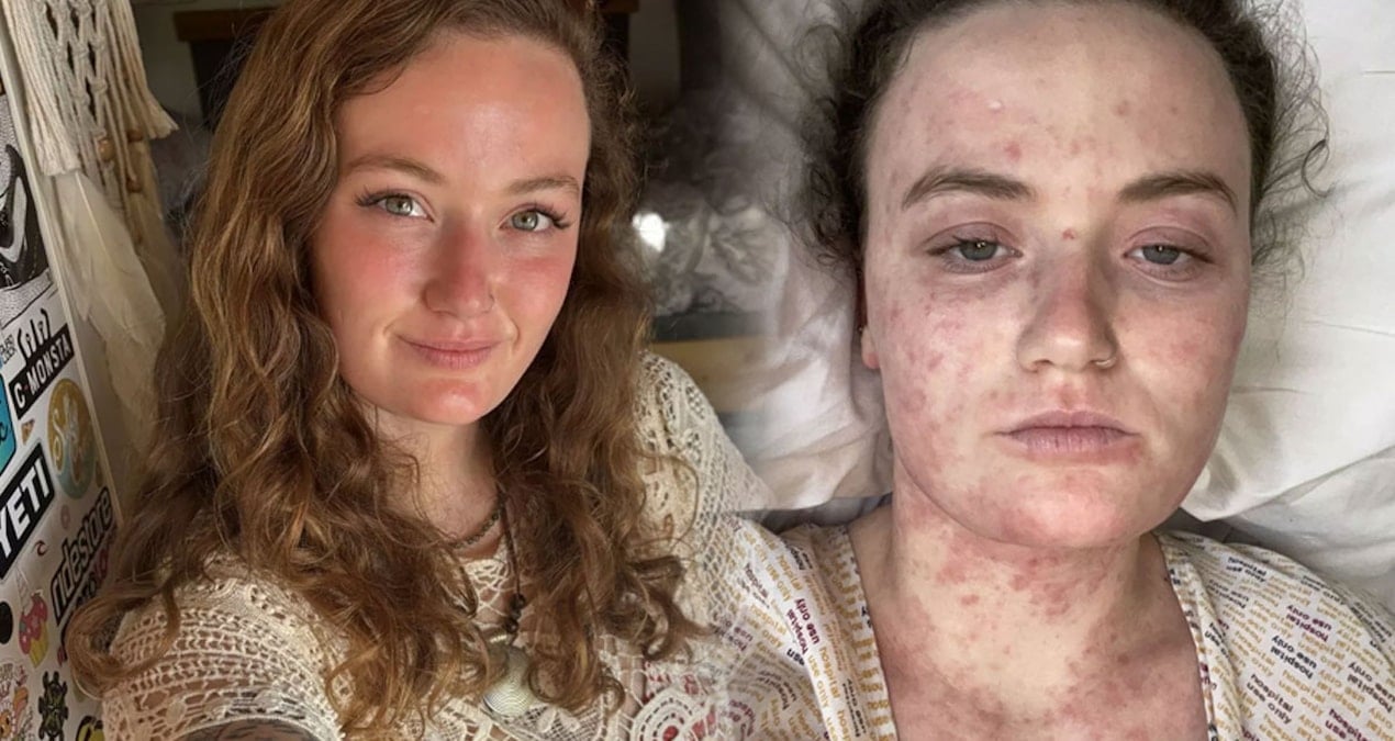 sirt agrisiyla basladi olumun kiyisindan dondu yanlis teshis hayattan kopariyordu Hb9vQUXU.jpg