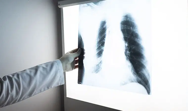 Uzmanından kritik uyarı: ‘Pişen yemeğin dumanı bile KOAH nedeni’